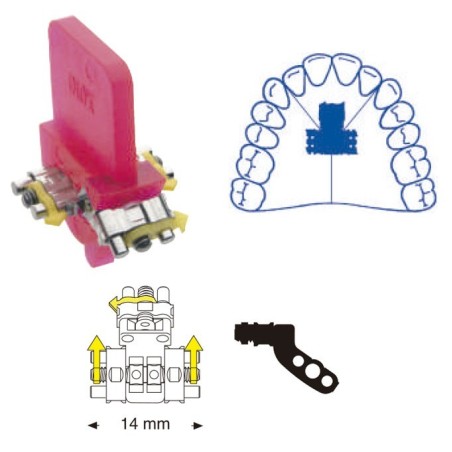 VIS EXPANSION TRIDIRECC BERTONI ACTIVACION 3 PUNTOS 14 mm 1 ud