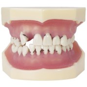 MODELE DE PERIODONTIQUE