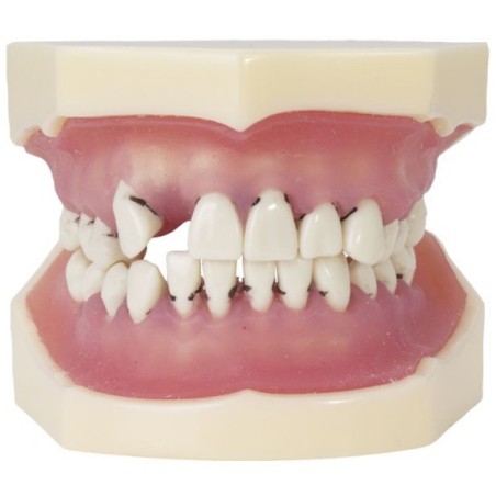 MODELE DE PERIODONTIQUE