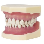 MODELE DE PERIODONTIQUE