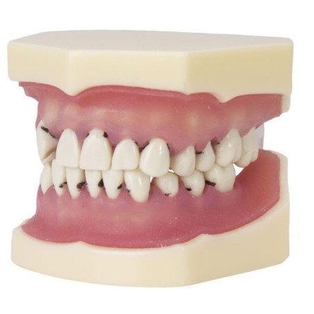 MODELE DE PERIODONTIQUE