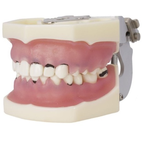 TYPODONTHE PERIODONTIQUE AVEC ARTICULATEUR