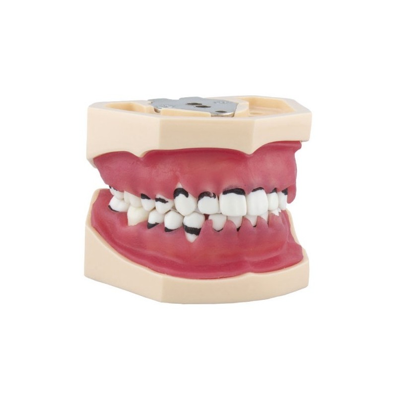 MODELE DE PERIODONTIQUE COMPLET