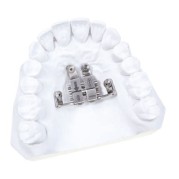 EXPANSOR PALATAL POUR TADS 10 mm