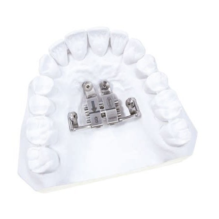 EXPANSOR PALATAL POUR TADS 10 mm